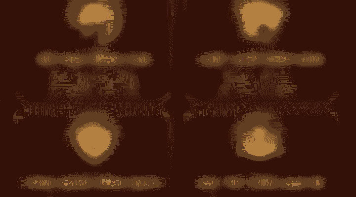bg-4